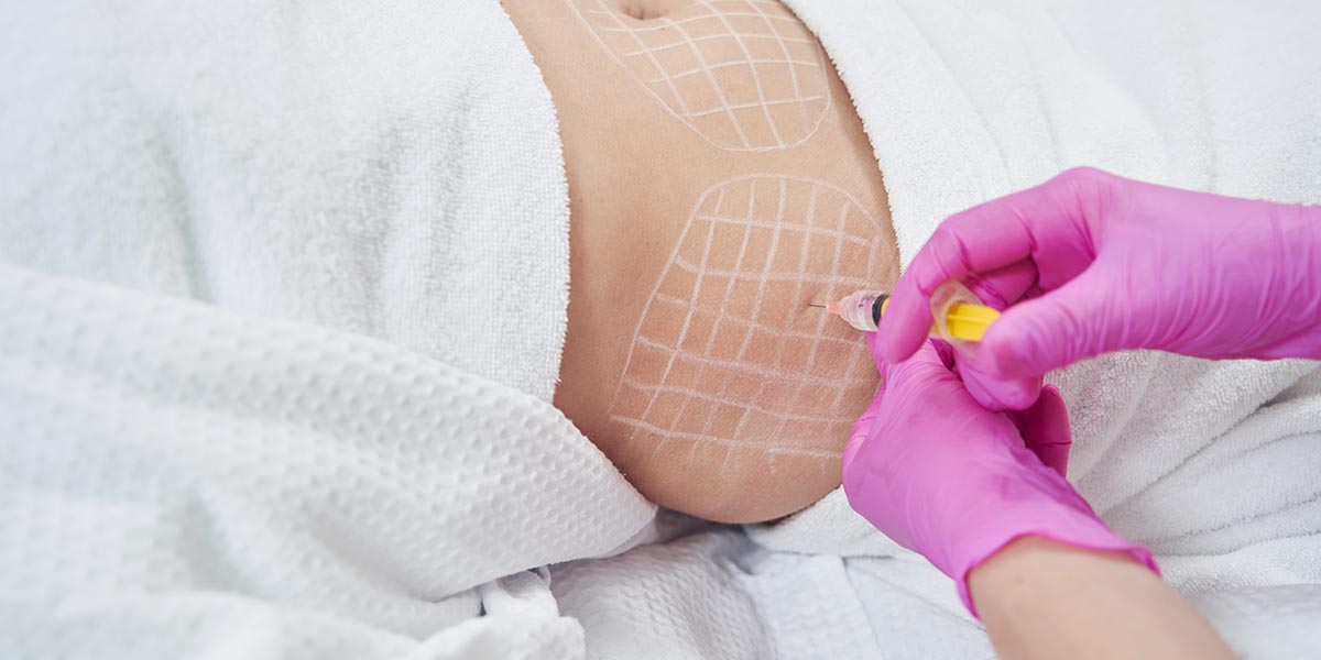 The Role of Aesthetic Practitioners applying Lemon Bottle Fat Dissolver